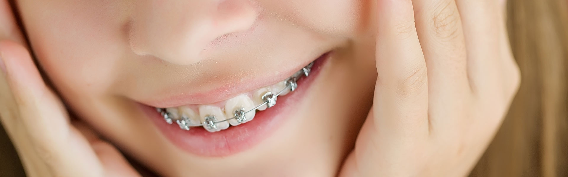 Caring for Braces Before and After Orthodontic Appointments