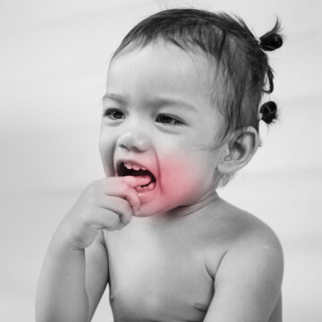 Common Children’s Tooth Injuries that Happen at Home